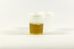 urine container